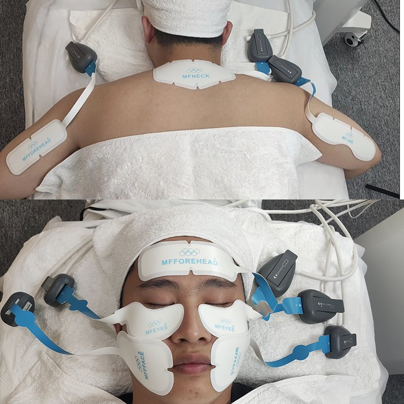 Microcurrent Facial Lifting Skin Tightening Anti Aging Wrinkle Removal Replacement Pads Machine for Electric EMS RF Face Lift Beauty Cheek Forehead Eye Bag Chin