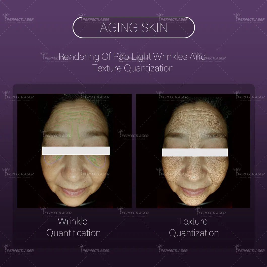 Best Ai Smart 15.6 Inch Screen Skin Analysis Machine