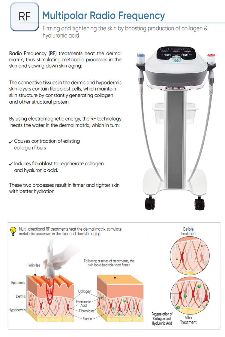 Treatment Flow 3