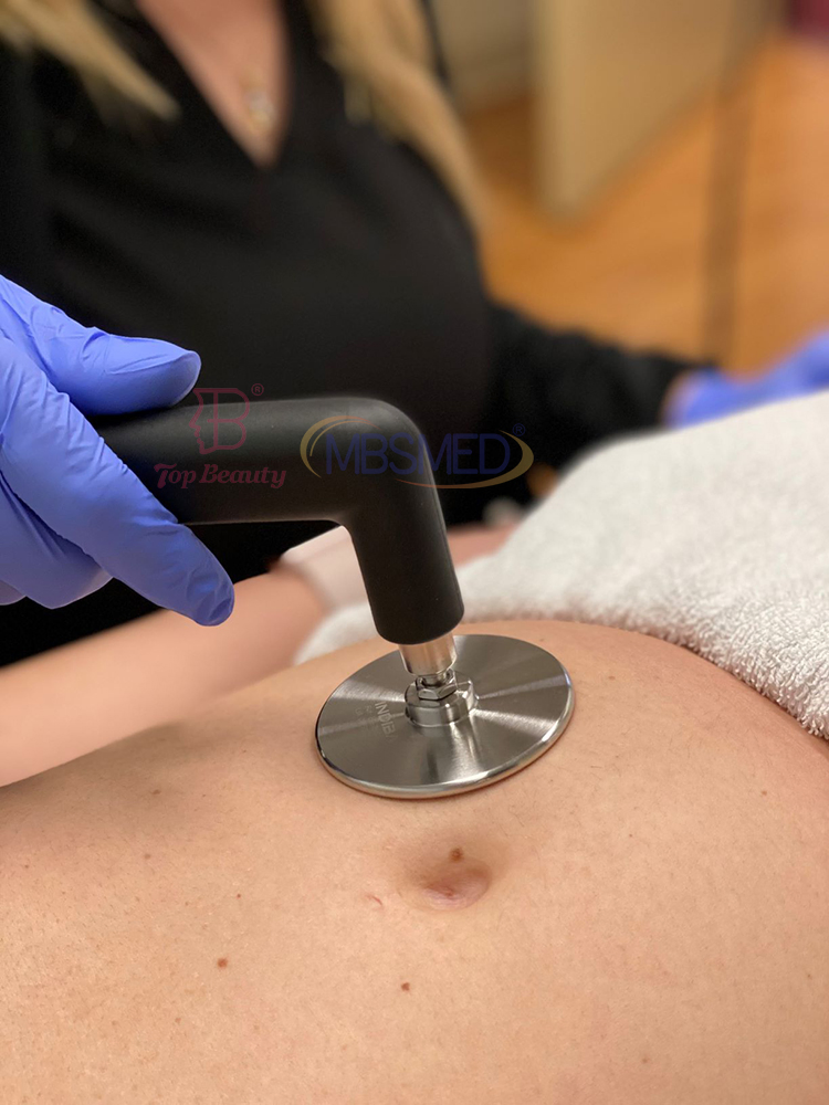 Portable Ret Cet Deepba Facial and Body Radiofrequency Tecar RF Radiofrequency RF Machine Skin Tightening