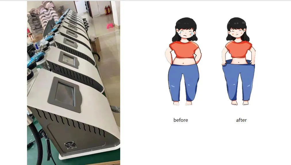 6 in 1 Ultrasound Cavitation RF Facial Body Slimming Machine