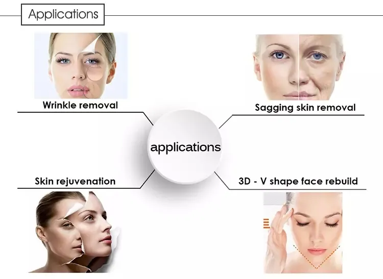 Hifu Ultrasound Facial Lifting Tightening Hifu Machine Treatment Position