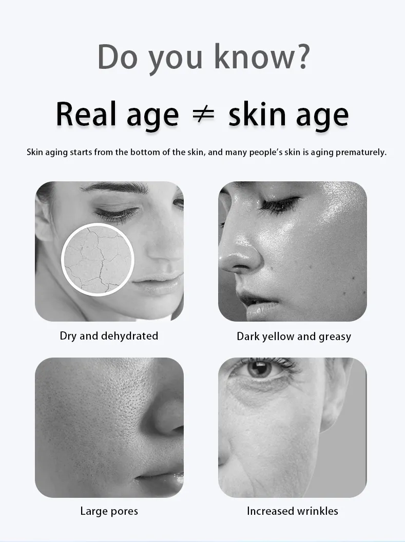 Hi-Mis Skin Management Device Hydrogen Oxygen Bubble Whitening Anti-Acne Facial Machine