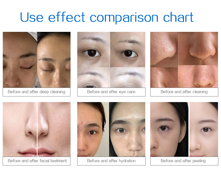 Salon 15in1 Hydro Microdermabrasion Oxygen Facial Machine Skin Tightening Oxygen Skin Care Cleaning Whitening with Skin Analyzer