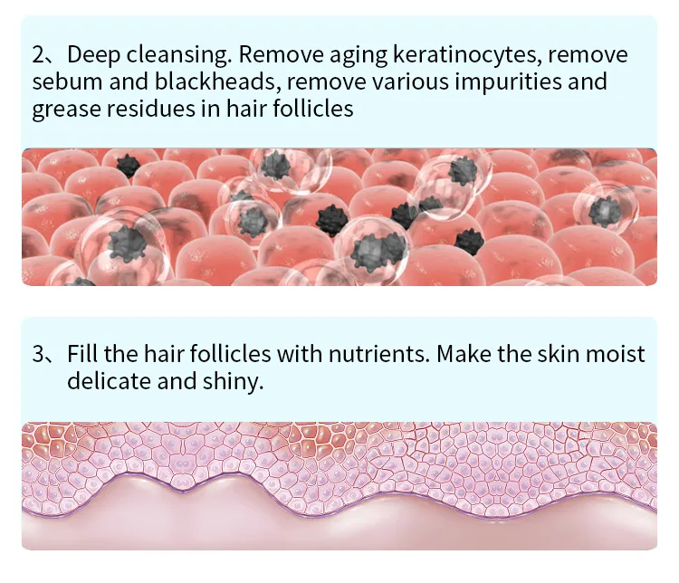Facial Cleaning Diamond Microdermabrasion Hydraskin Machine Oxygen Jet Facial Machine