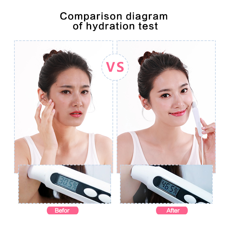 Hydrodermabrasion Face Cleaning Machine View 5