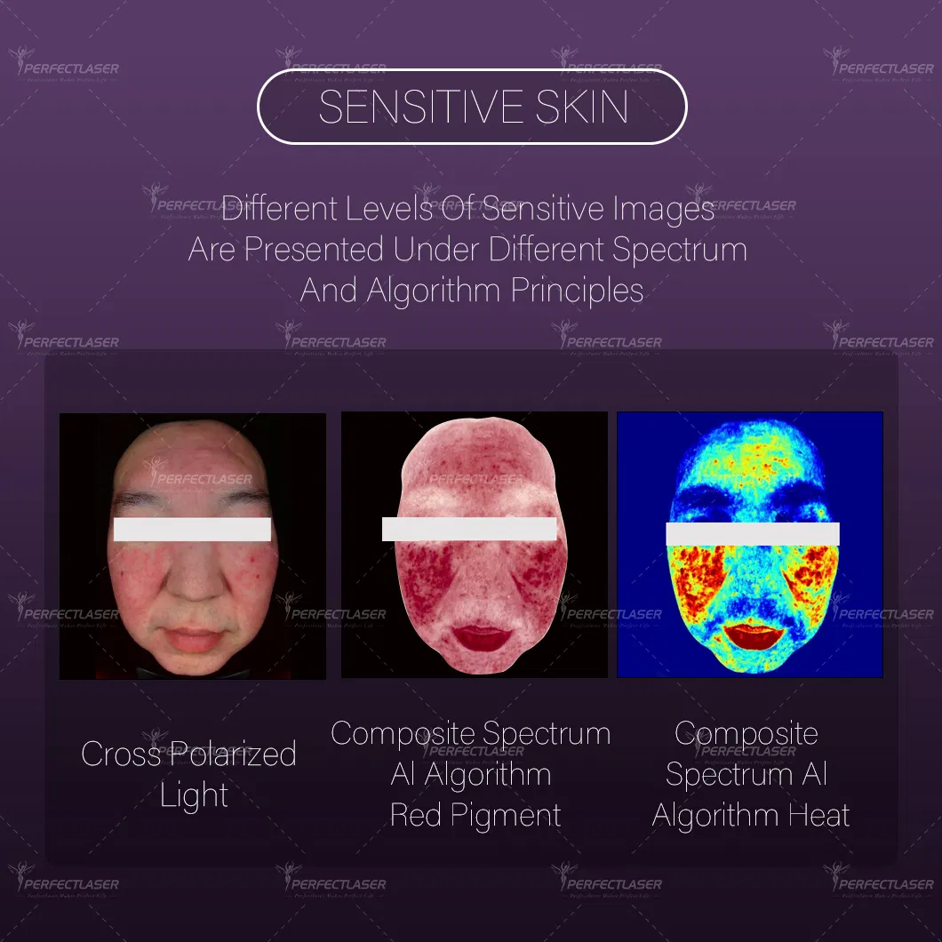 Best Ai Smart 15.6 Inch Screen Skin Analysis Machine
