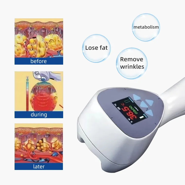 Collagen Machine Side Profile