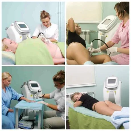 RF skin tightening machine specification details