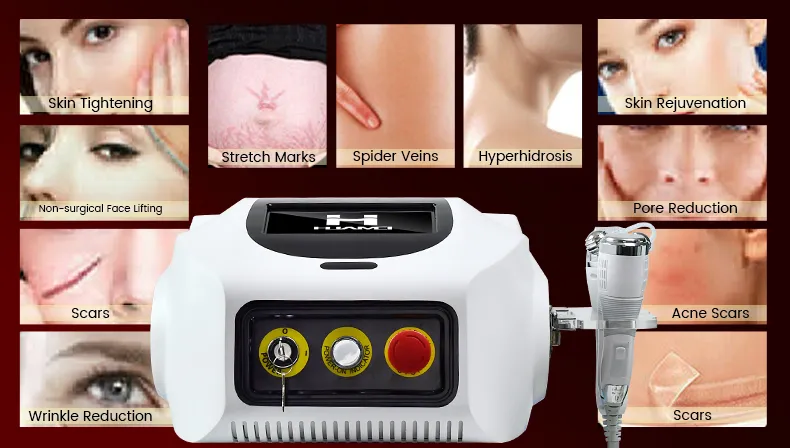 Fractional RF Microneedle Acne Treatment Facial Portable Beauty Machine