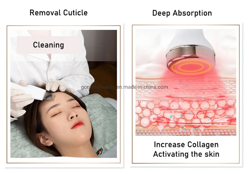 7 in 1 Jet Peel Oxygen Jet System 6-Polar RF Aqua Peel Hydra Dermabrasion Oxygen Facial Machine