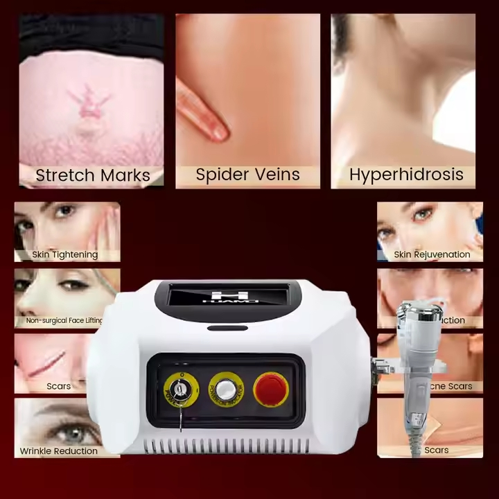 Fractional RF Microneedle Acne Treatment Facial Portable Beauty Machine
