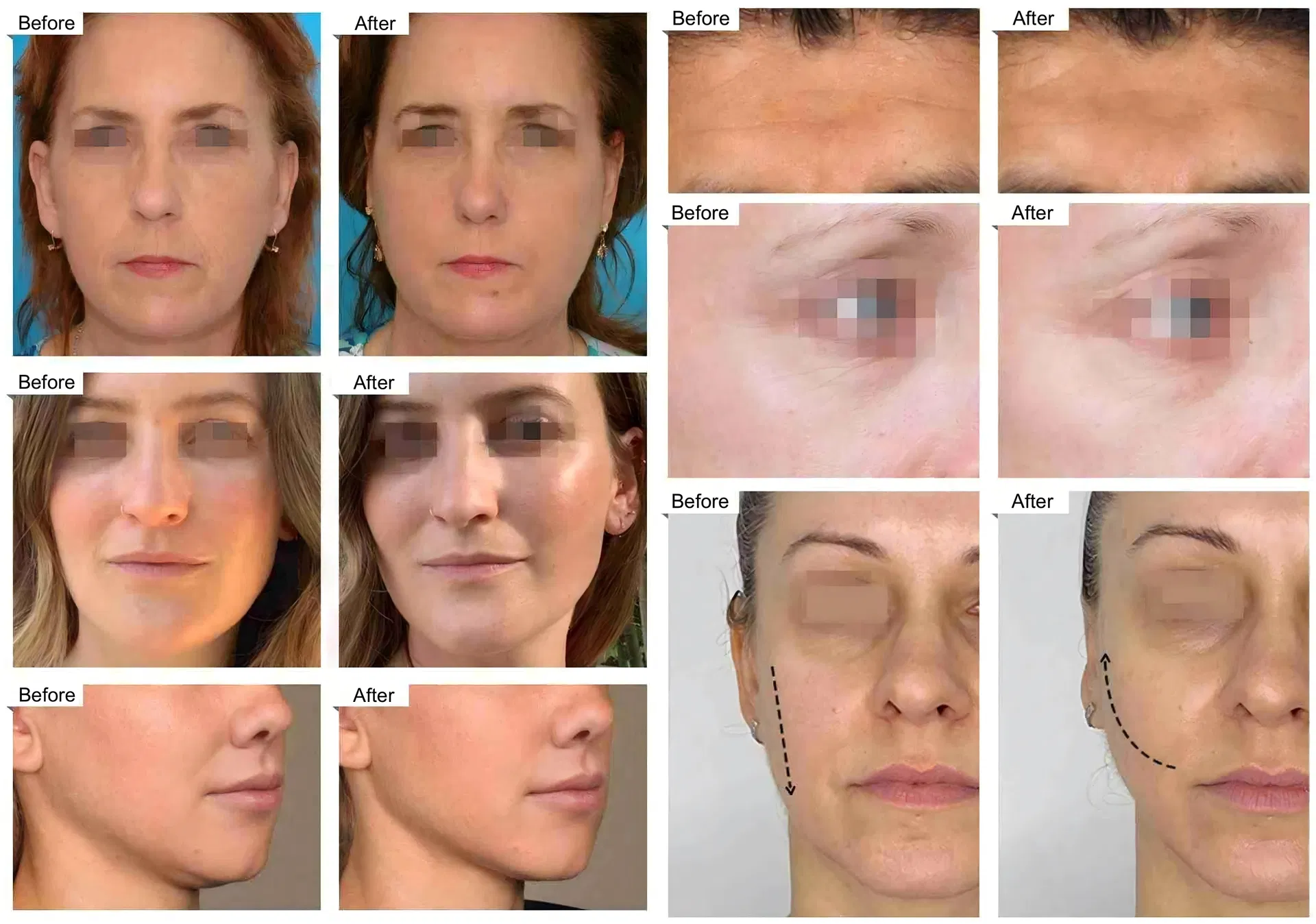Before & After treatment result comparison 2
