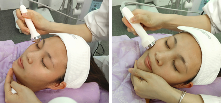 Ultra Skin Tightening