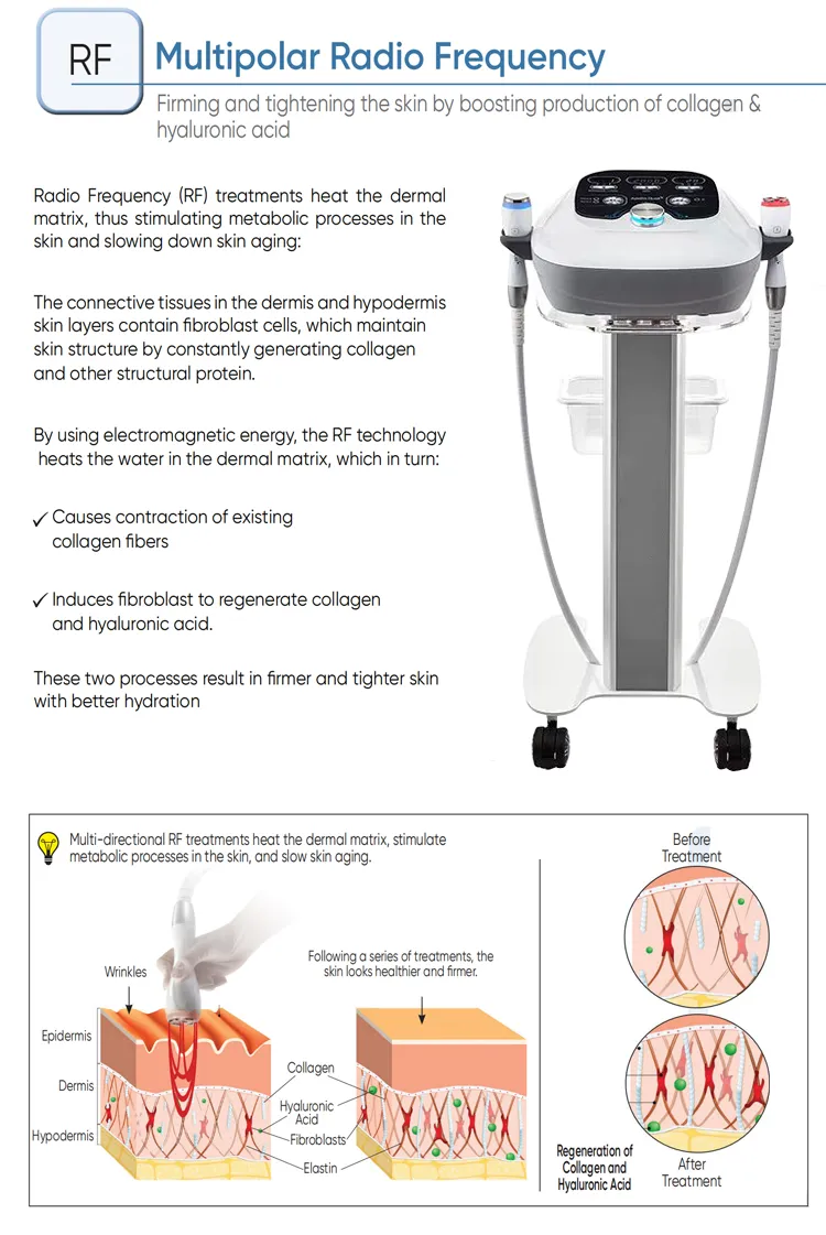 Advanced Multi-polar RF Energy Delivery
