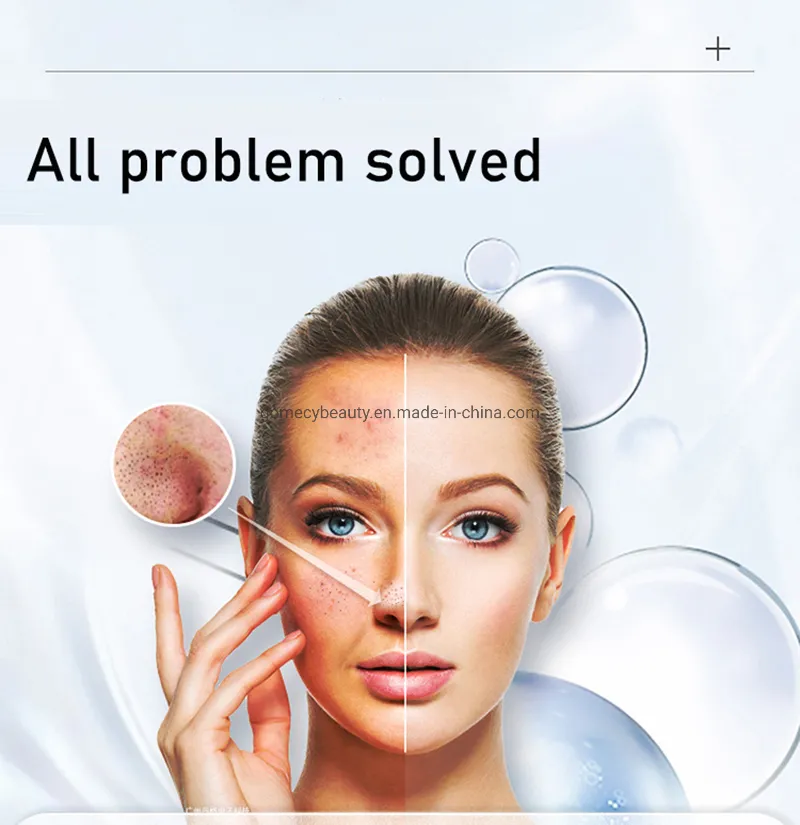 7 in 1 Jet Peel Oxygen Jet System 6-Polar RF Aqua Peel Hydra Dermabrasion Oxygen Facial Machine