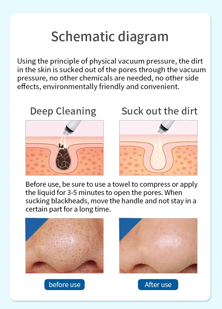 Facial 7 in 1 Microdermabrasion Hydra Oxygen Jet Facial Cleaning Machine