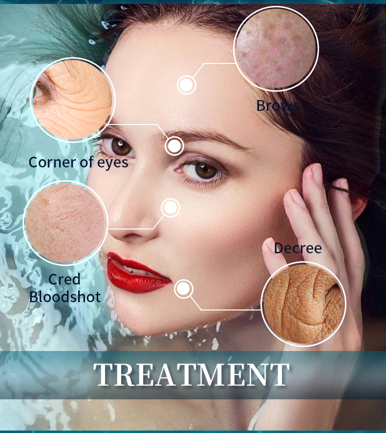 CE High Pressure Water Hydro Microderm Hydra Oxygen Jet Peel Facial Machine Peeling Hydrotherapy Machine