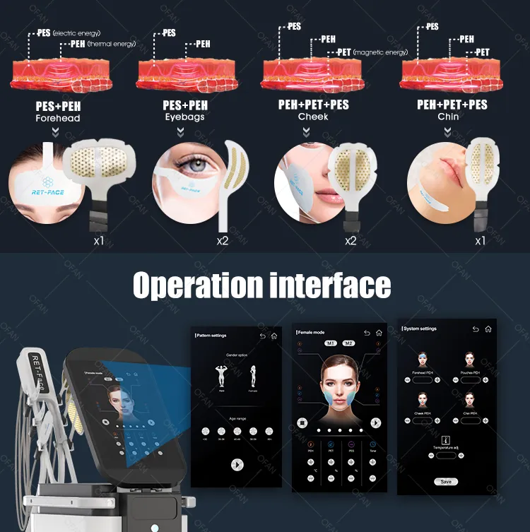 RF Wrinkle Removal PE Face Machine for Facial Loose Skin Anti-Aging Beauty Salon Equipment