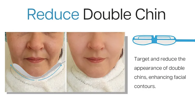 Advanced Non-Invasive EMS Facial Beauty Machine for Youthful Skin