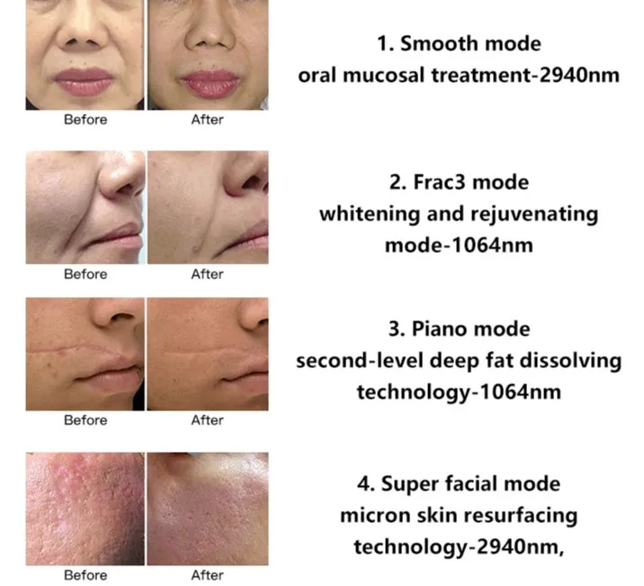 Laser Scar Removal Before & After Guide