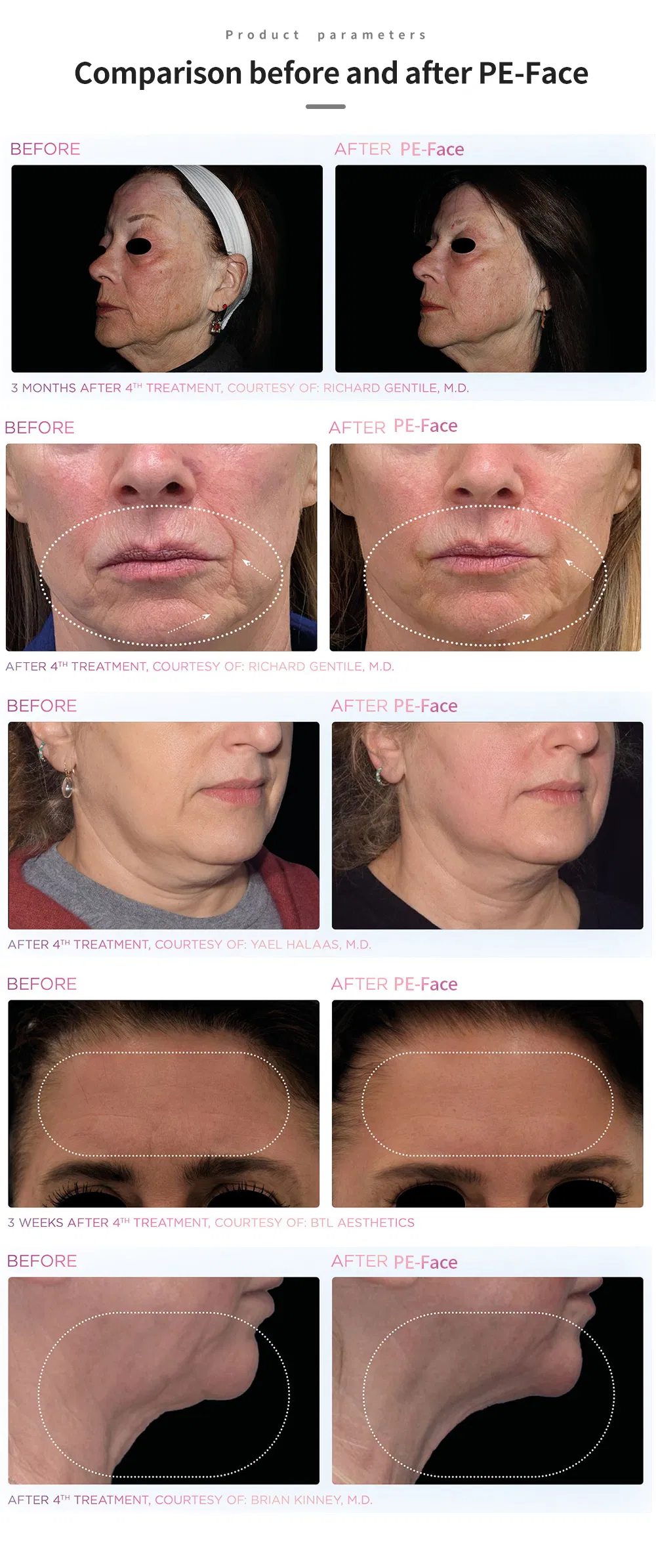 Before & After Results