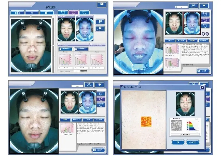 Facial Scanner Skin Test Analyzer Skin Analyzer Camera 3D Mni Digital Skin Analyzer Visia Skin Analysis Machine for Sale