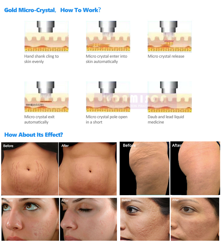 Treatment Results Guide