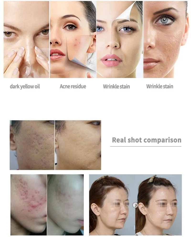Oxygen Jet Facial Machine