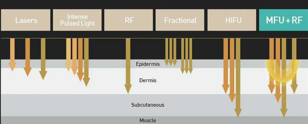 MFU RF detailed structure