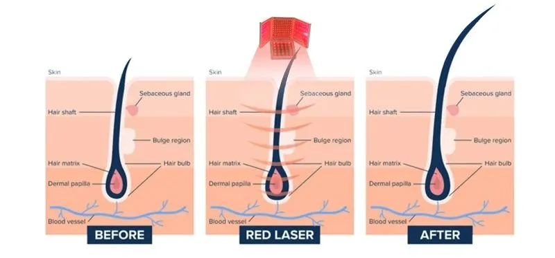 Hair Regeneration Principle Diagram