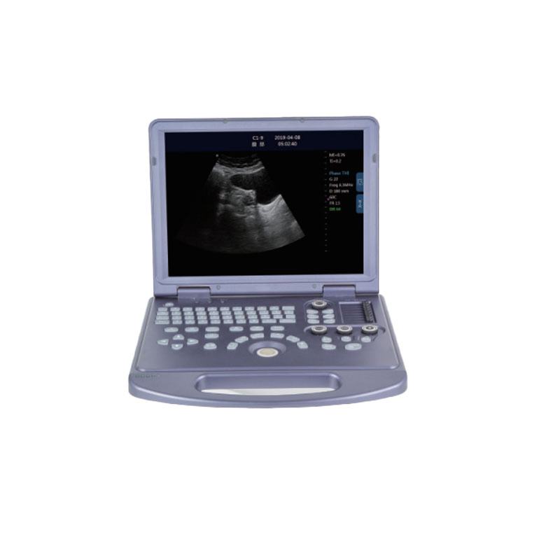 2025China PC Platform Full-Digital Black and White Ultrasound Diagnostic System