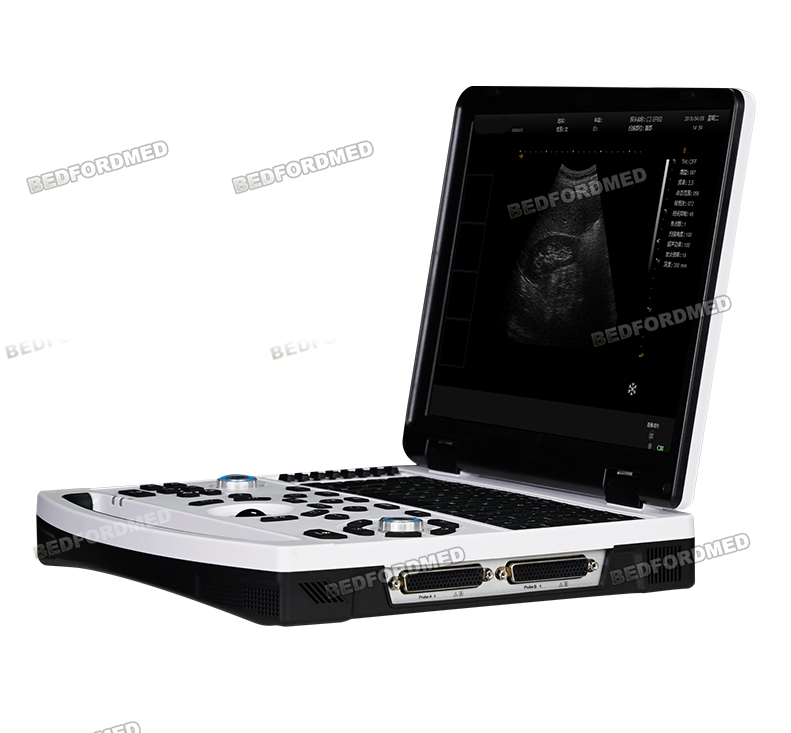 Hospital Surgical Intelligent Laptop Ultrasound Diagnostic System Me-690 Y3.0