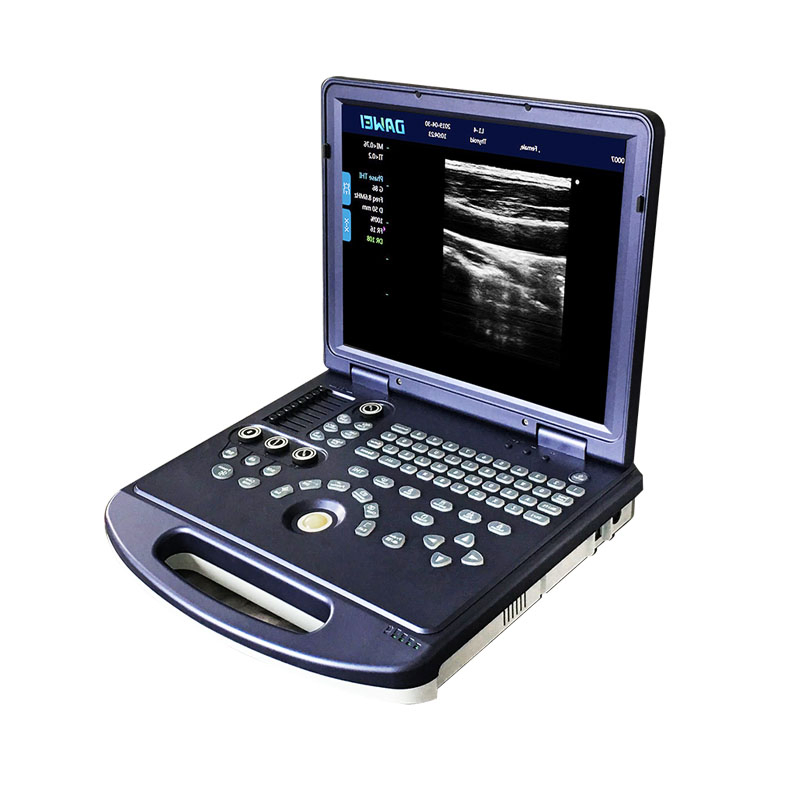 Cy-Dw360 PC Platform Full-Digital Black and White Ultrasound Diagnostic Equipment