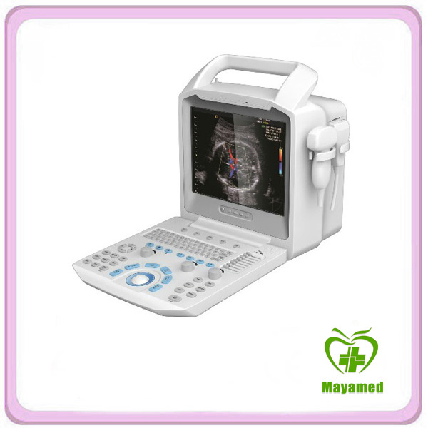 All Digital Color Doppler Ultrasonic Diagnostic System