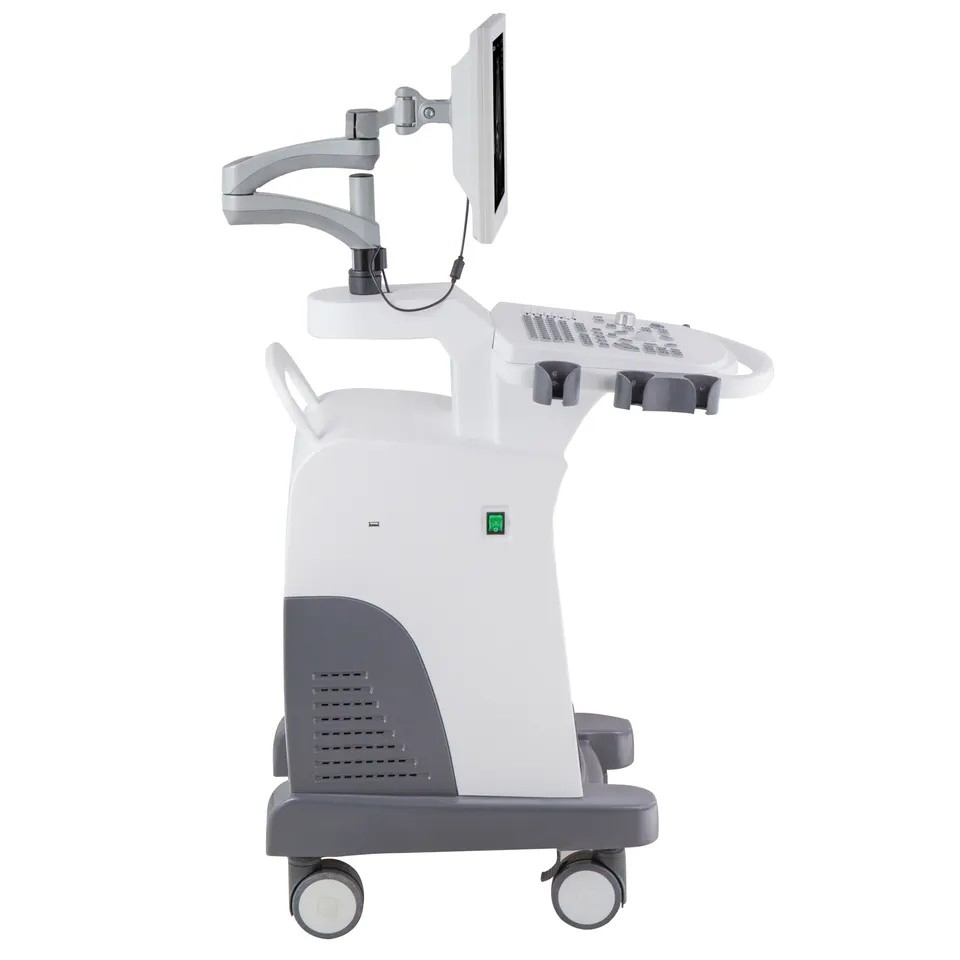 Black and White PC Platform Full-Digital Trolley Ultrasound Diagnostic System