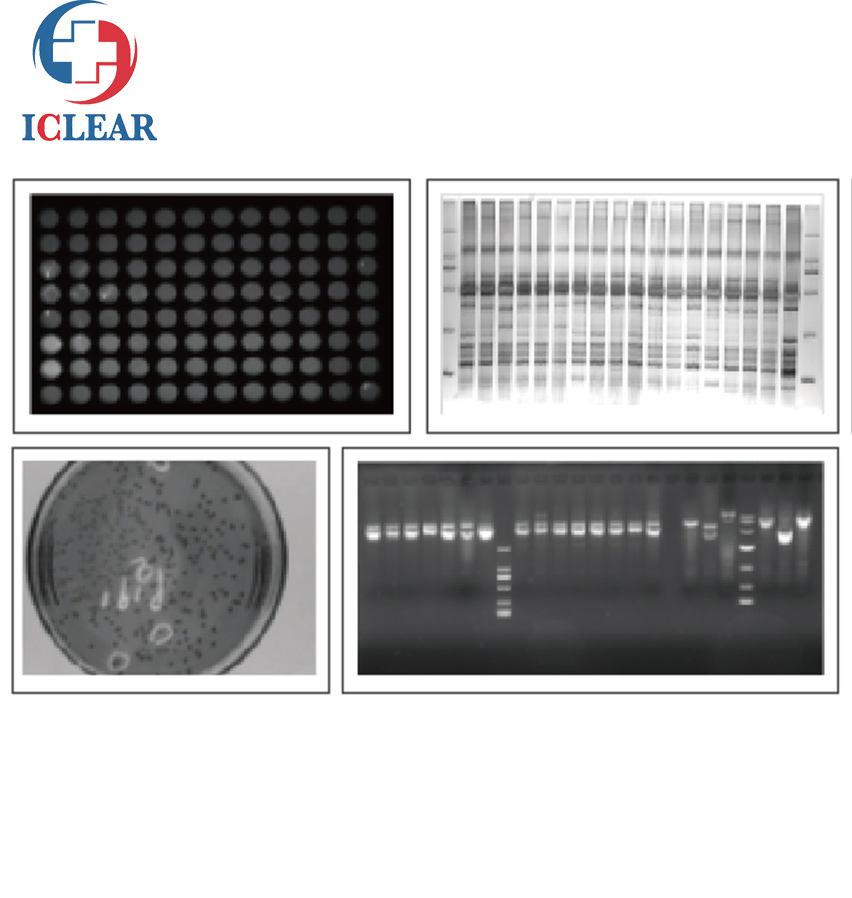 5.2 Megapixels DNA/Rna and Protein UV Gel Doc Imaging Analysis System