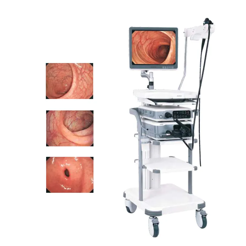 HD-330 Endoscopy System 4