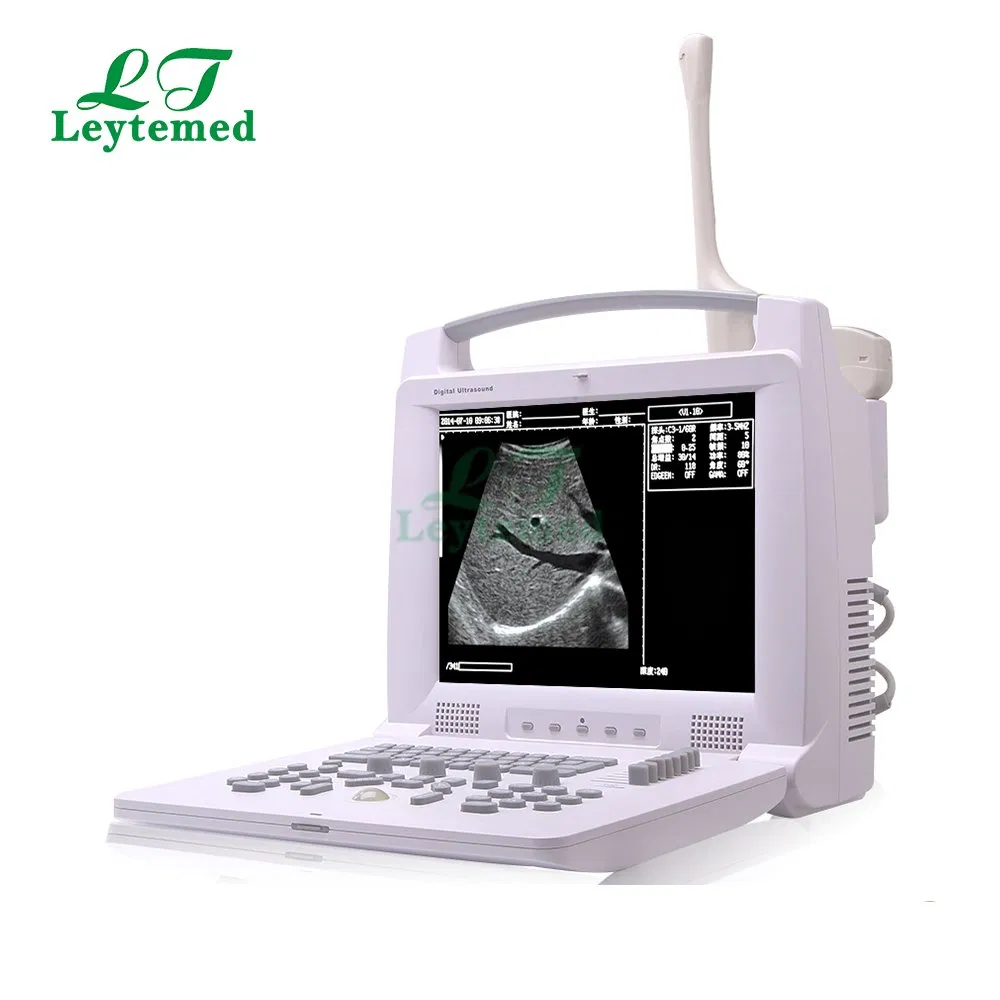 Ltub29 Portable Convex Linear Ultrasound Scanning Diagnostic Ultrasound System