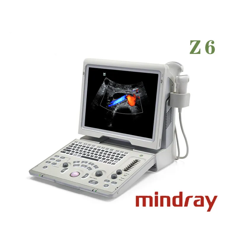Ultrasound Display 2