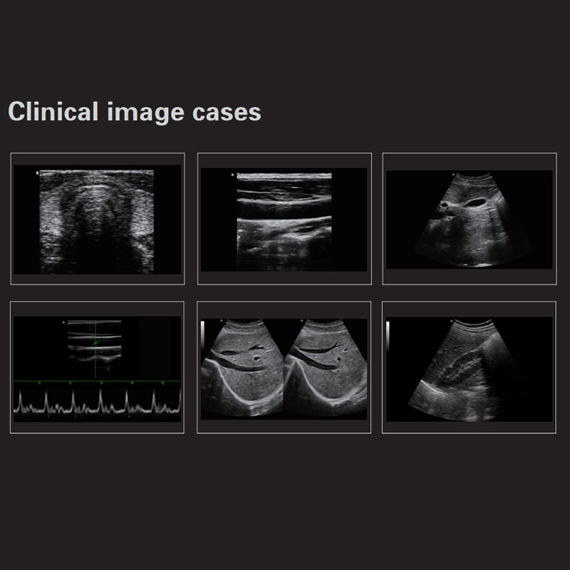 Cy-Dw360 PC Platform Full-Digital Black and White Ultrasound Diagnostic Equipment