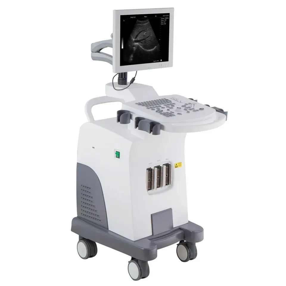 Ultrasound System View 6