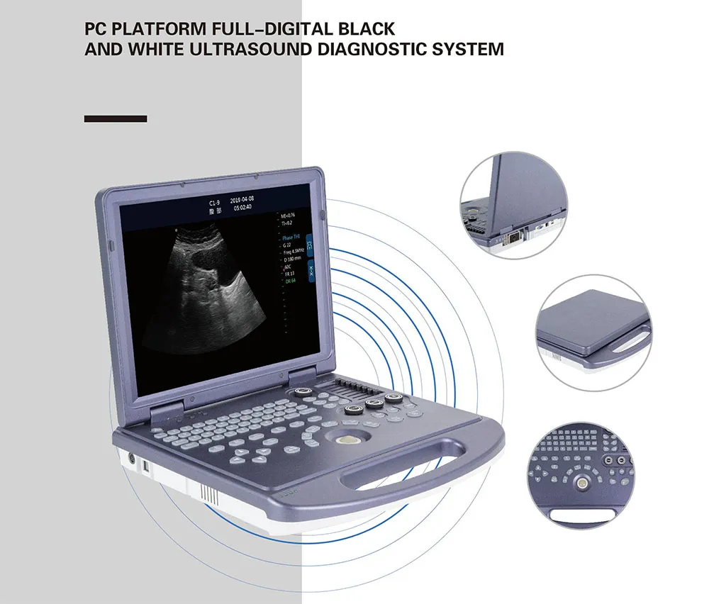 Ultrasound Equipment View 1
