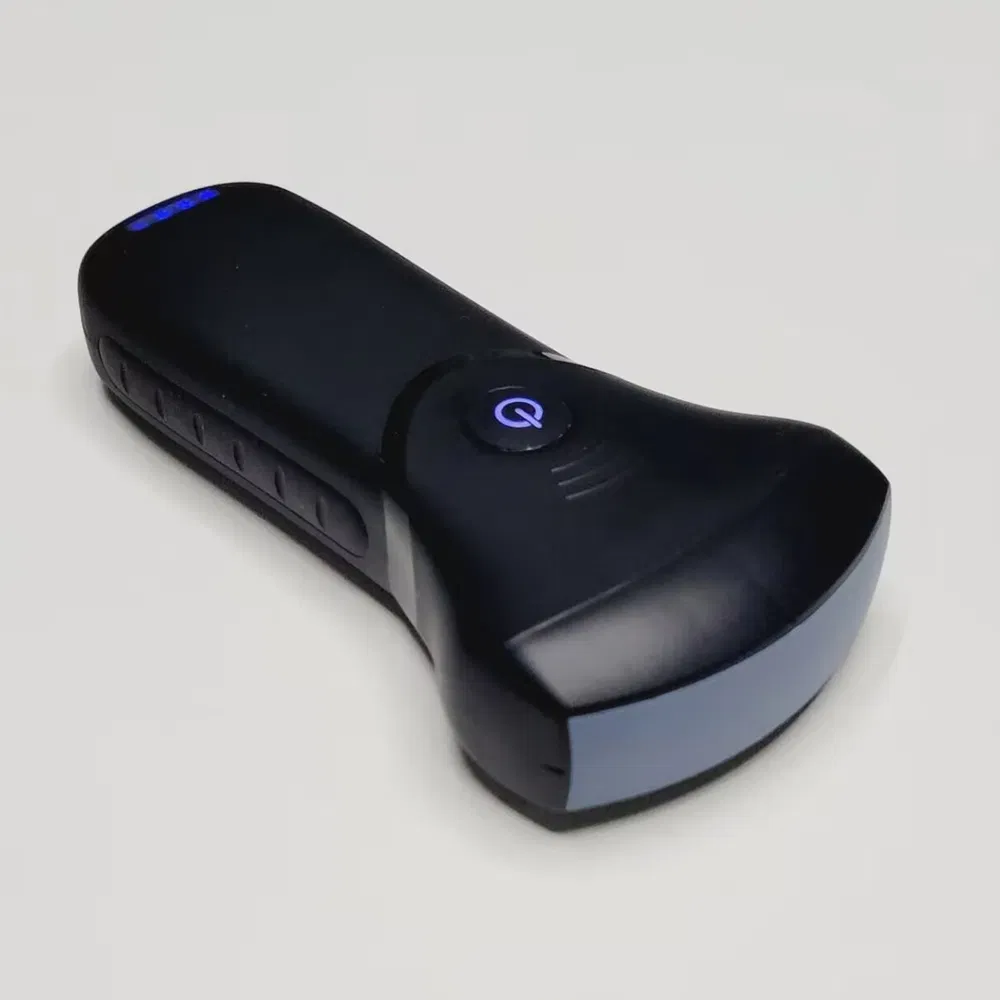 Handheld Precision Multi-Platform Ultrasound System Probe for Kidney and Lung Analysis