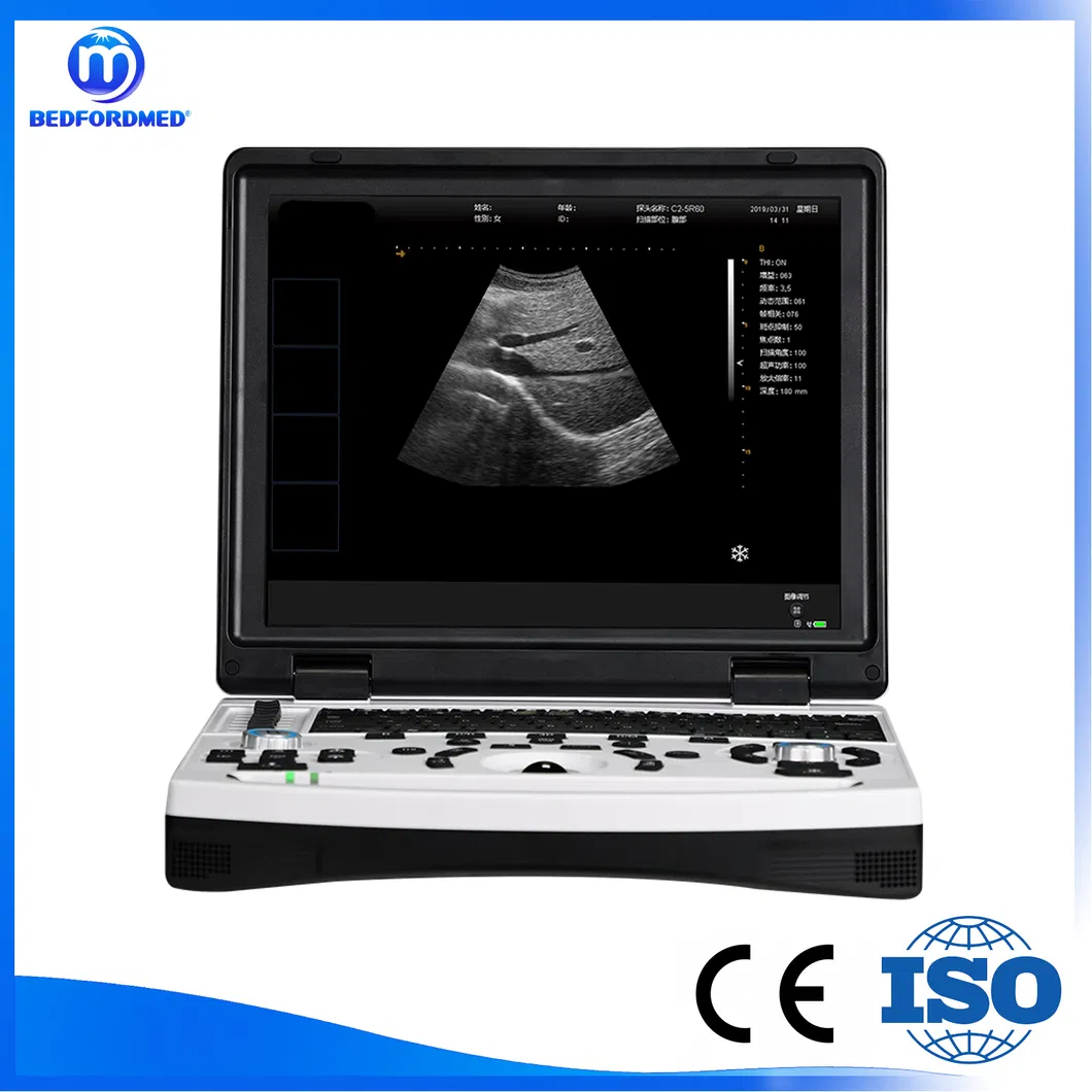 Laptop Ultrasound Diagnostic System