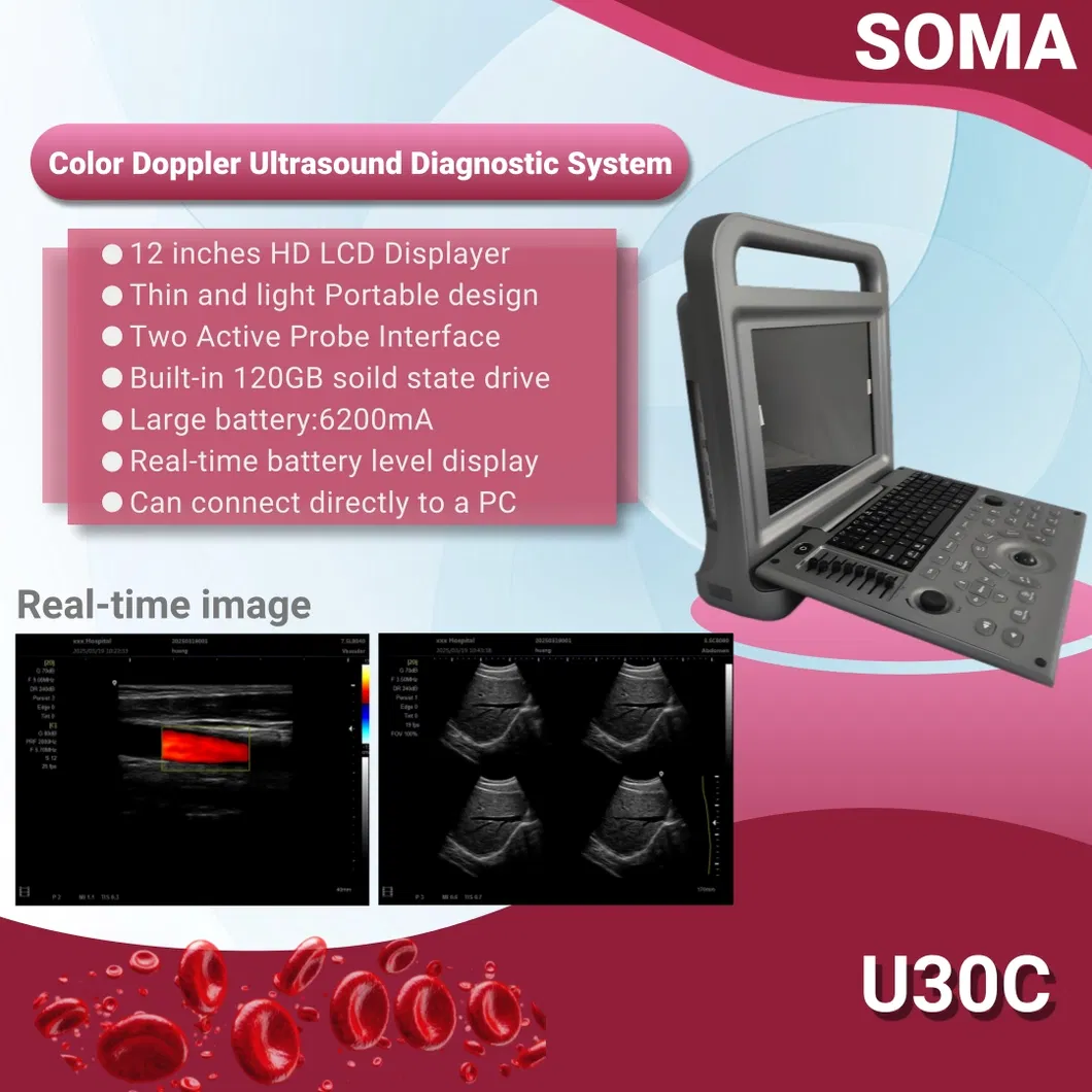 U30C Product Display