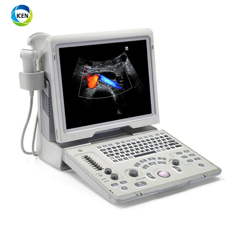 Ultrasound Display 1