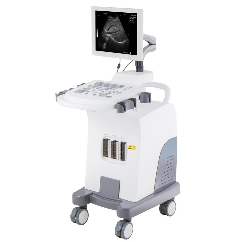 Black and White PC Platform Full-Digital Trolley Ultrasound Diagnostic System