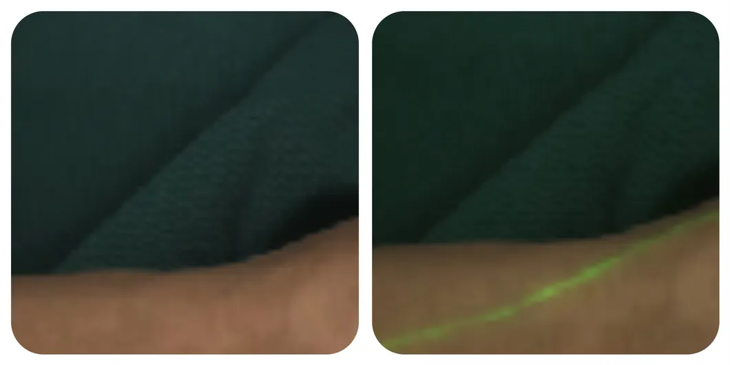 Upper limb lymphatic mapping