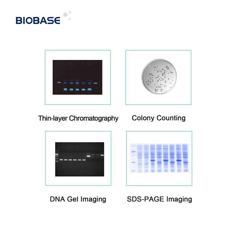 Biobase DNA Gel Documentation System Reader Gel Imaging Analysis Instrument